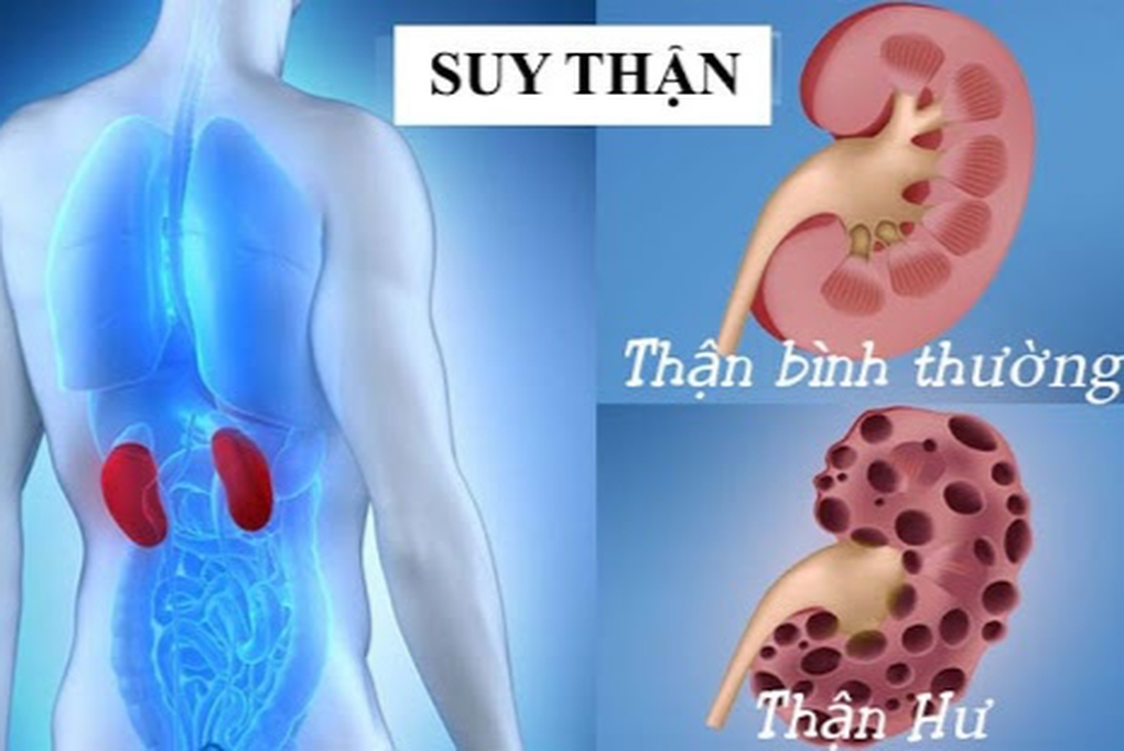 Tin tức 1