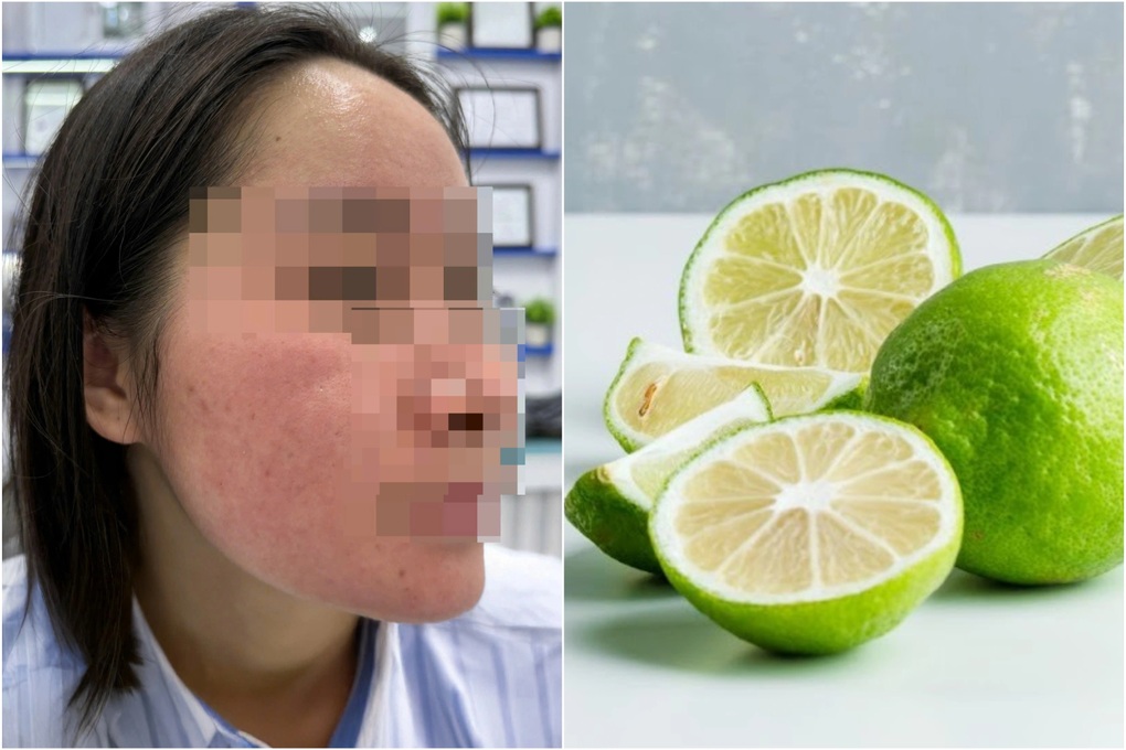Tin tức 1