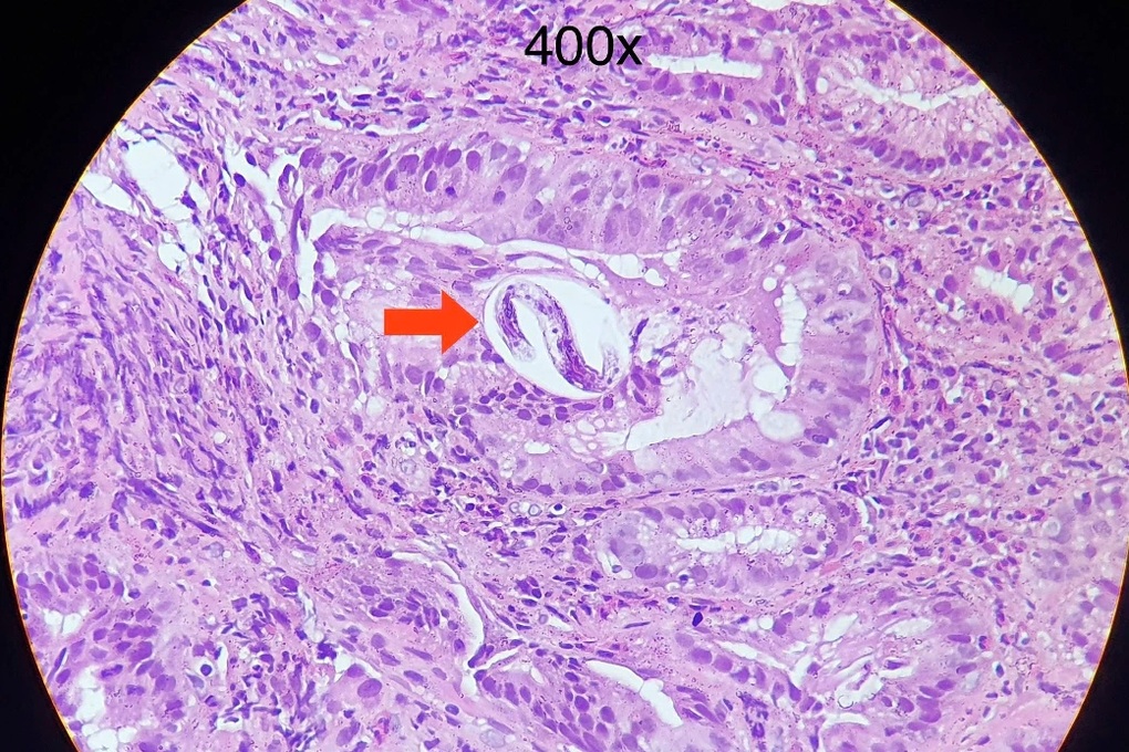 Tin tức 1