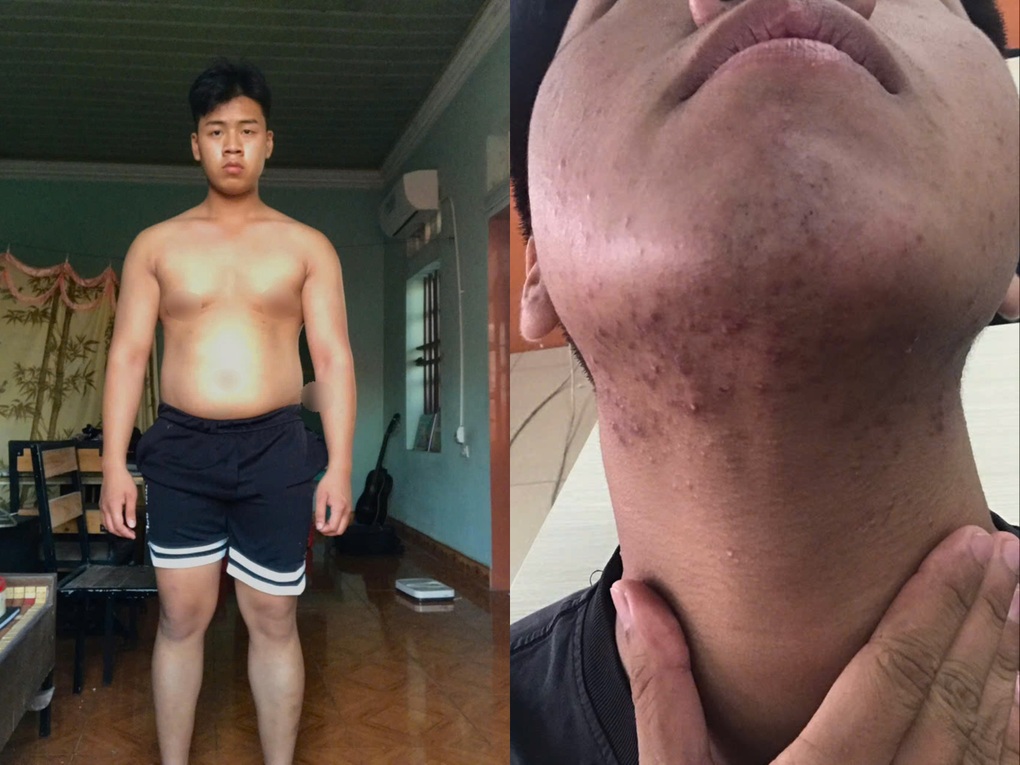 Tin tức 1