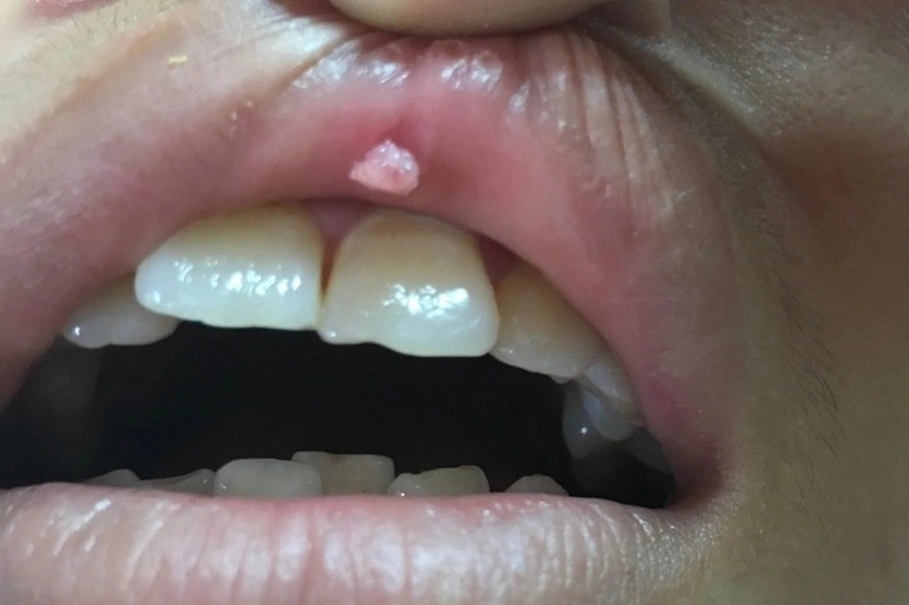 Tin tức 1