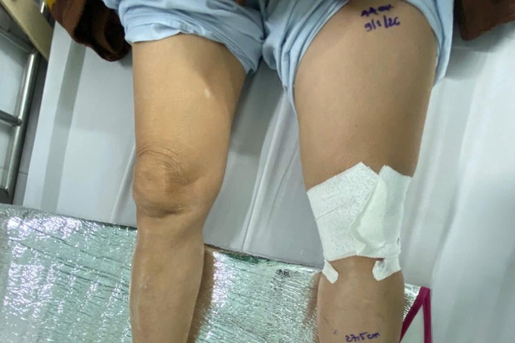 Tin tức 1